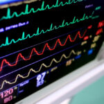 Healthcare heart monitor