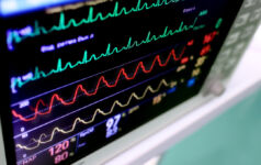 Healthcare heart monitor