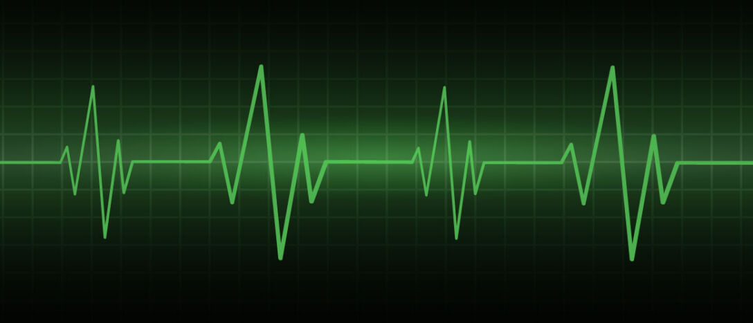 Hospital heart monitor showing a patient's heart rate