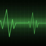 Hospital heart monitor showing a patient's heart rate