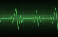 Hospital heart monitor showing a patient's heart rate