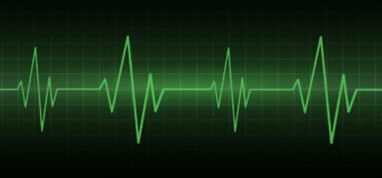 Hospital heart monitor showing a patient's heart rate